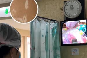 小孩的臉上長白斑怎么回事